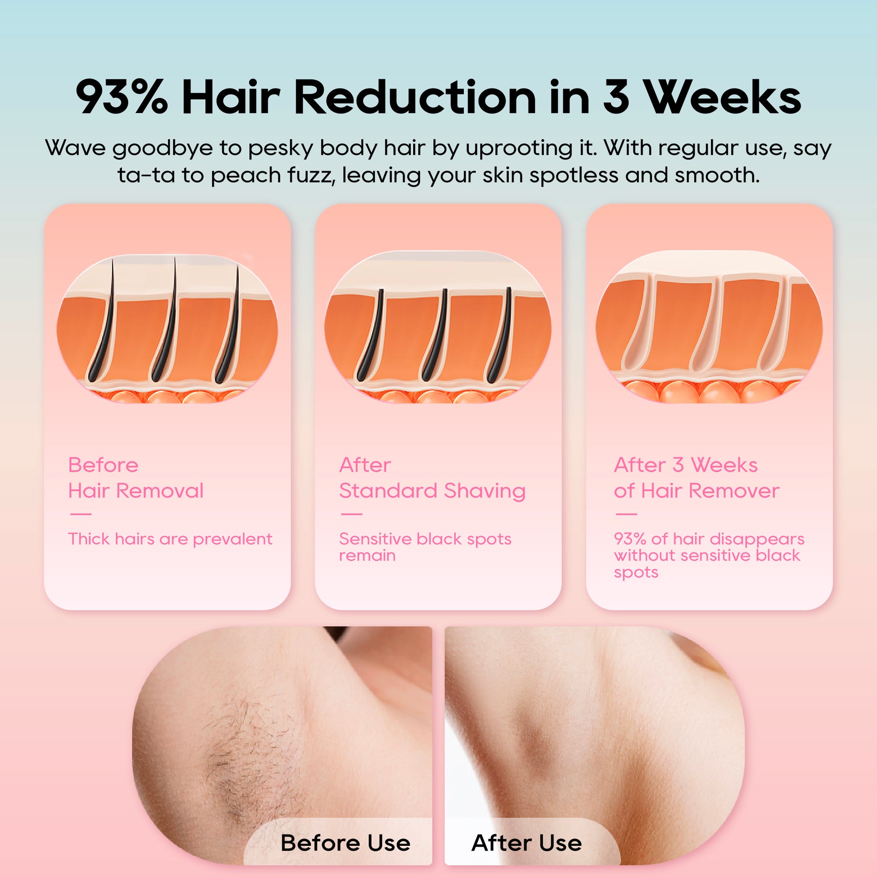Dreame IPL Hair Removal