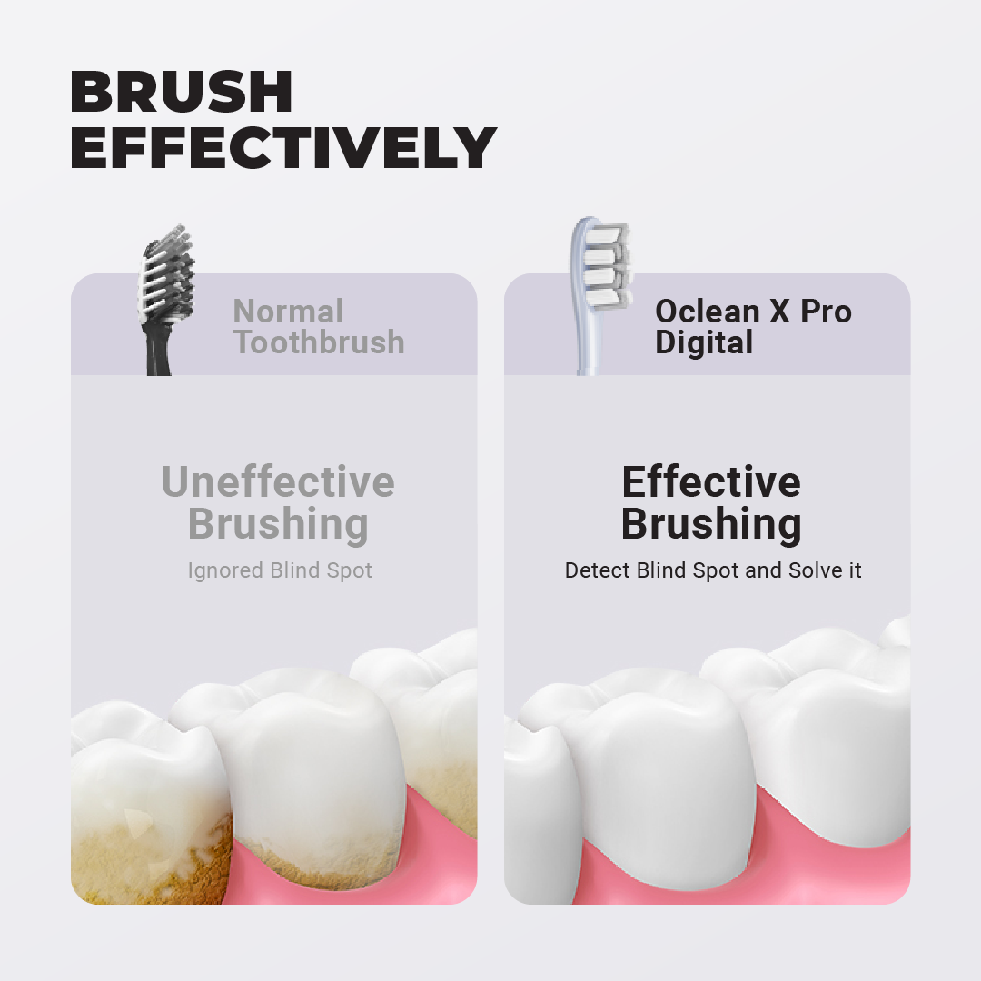 Oclean X Pro Digital Instant Feedback for Missed Areas Maglev Motor with Premium brush head