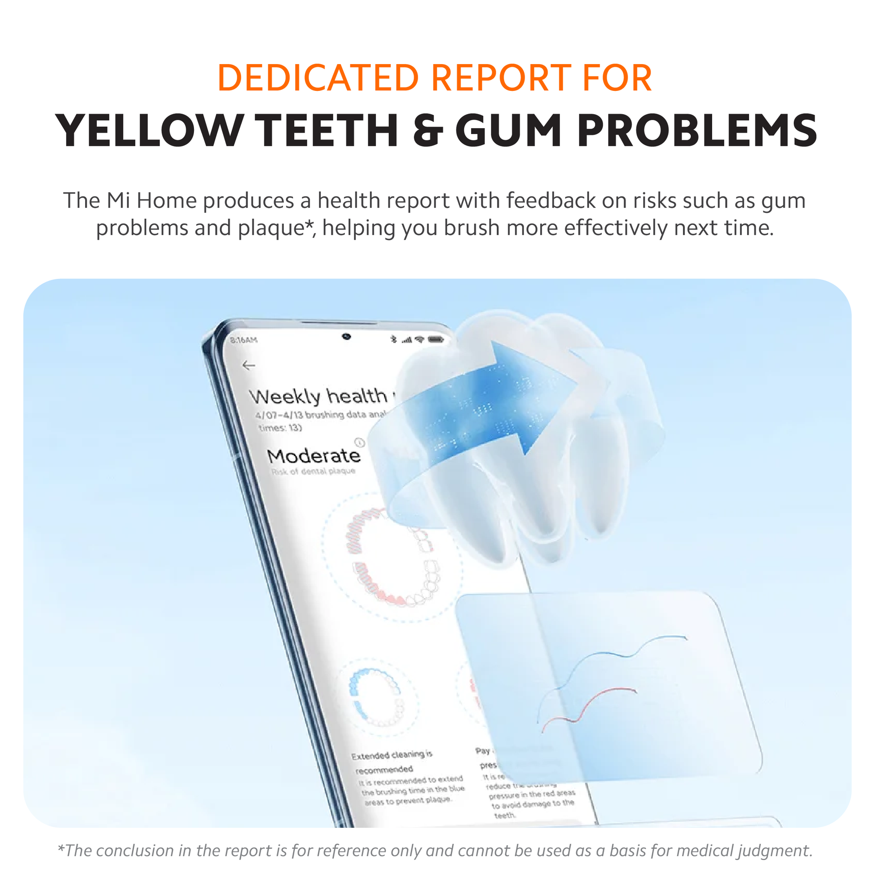 Xiaomi Smart T501 Electric Smart Oral Toothbrush 150 Days Battery Over Pressure Indicator AI Mode White / Grey