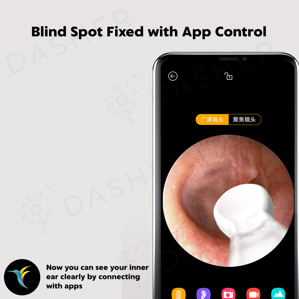 Bebird X17 Pro Smart Visual Ear Stick (18pcs Ear Parts)